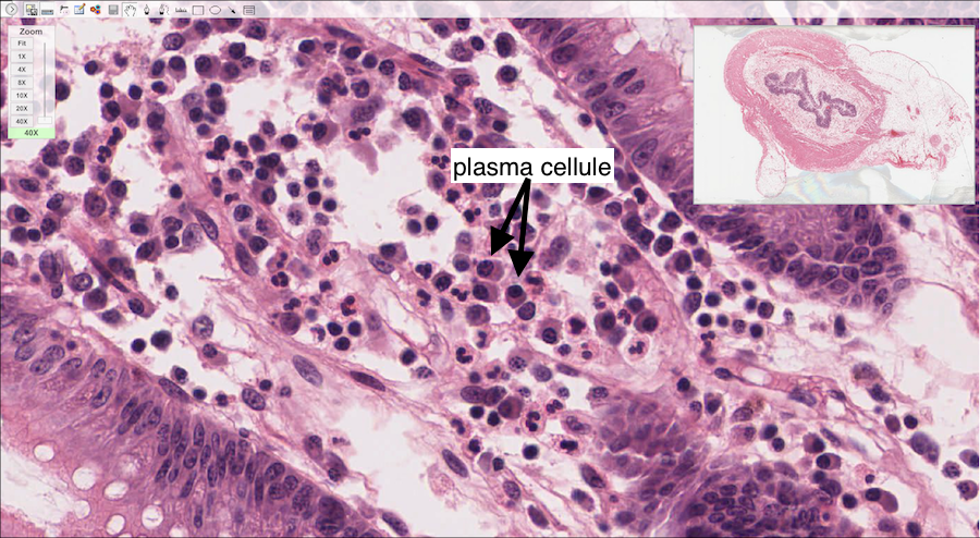 plasma cellule