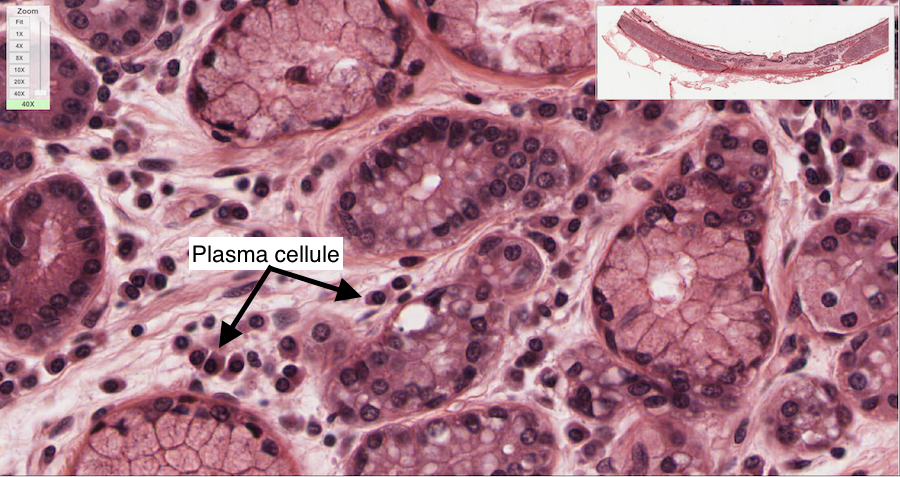 plasma cellule della trachea
